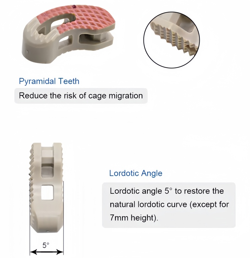 T-PAL Peek Cage