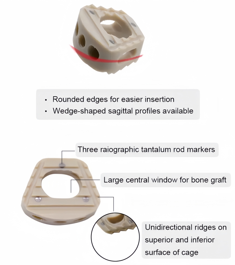 Cervical Peek Cage-II