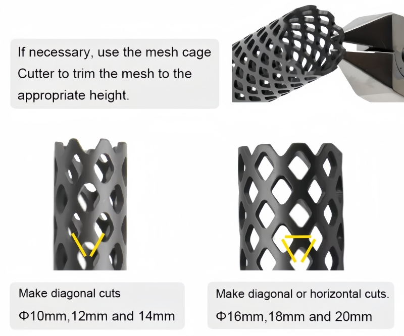 Titanium Mesh Cage