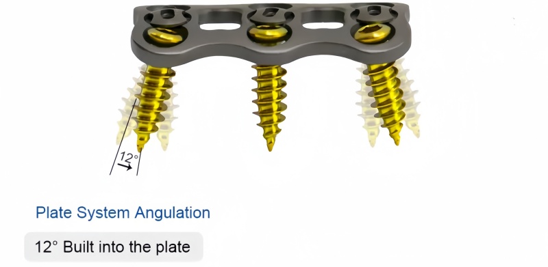 Anterior Cervical Plate-I-MakeUp