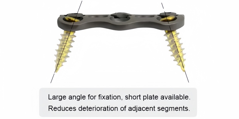 Anterior Cervical Plate-I-MakeUp