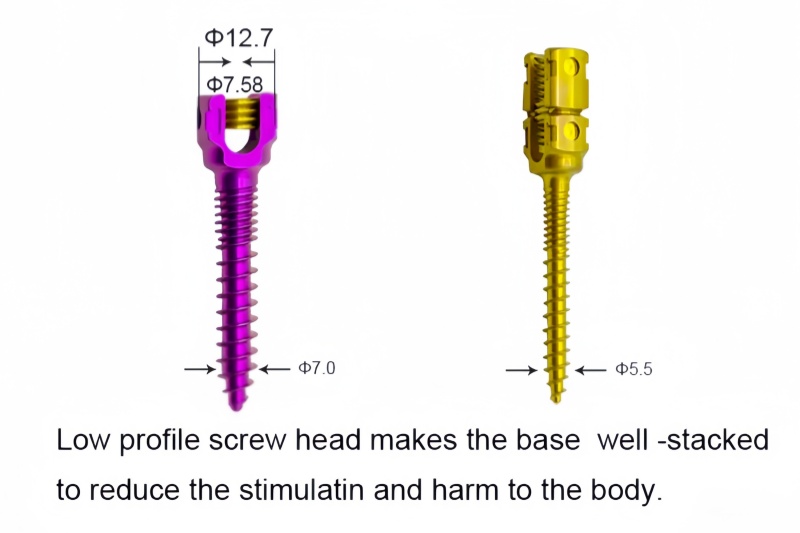 5.5 Spinal Pedicle Screw System 