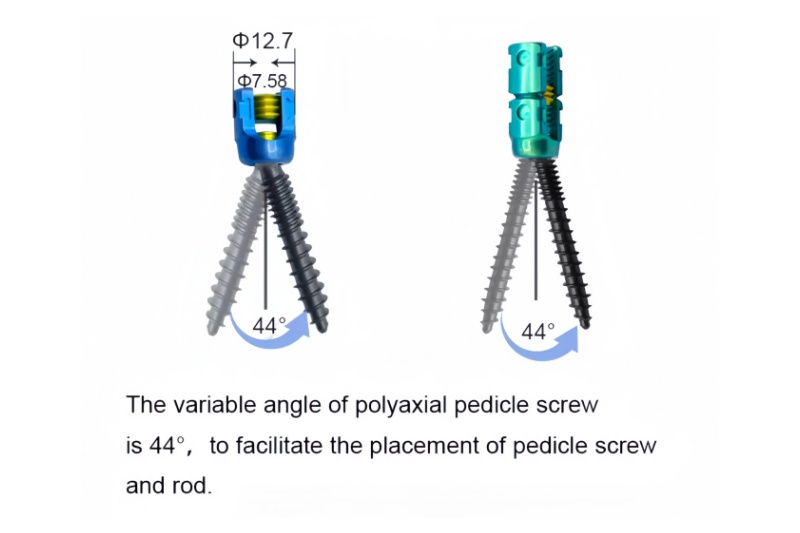 5.5 Spinal Pedicle Screw System 