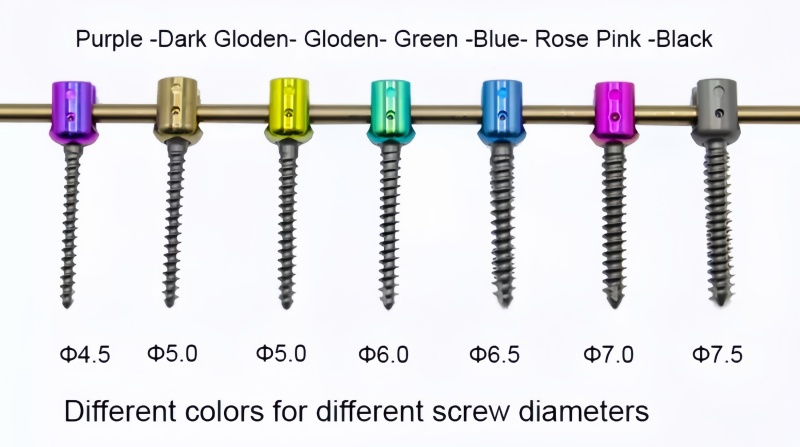 6.0 Spinal Pedicle Screw System