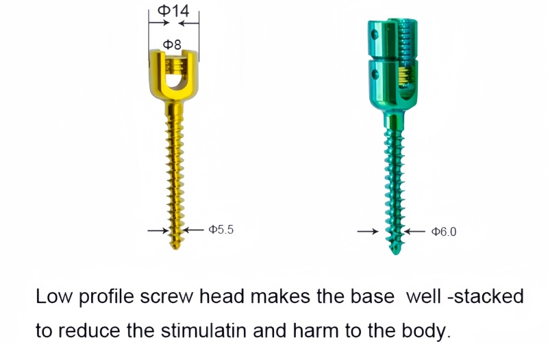 6.0 Spinal Pedicle Screw System