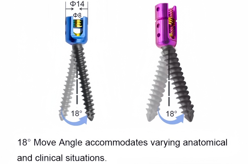 6.0 Spinal Pedicle Screw System