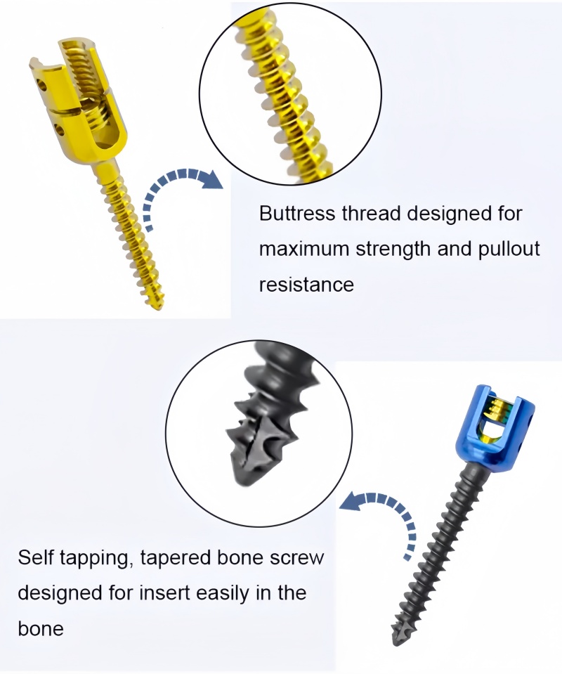 6.0 Spinal Pedicle Screw System