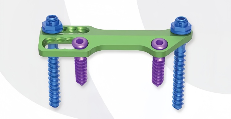 Anterior Thoracolumbar Plate System