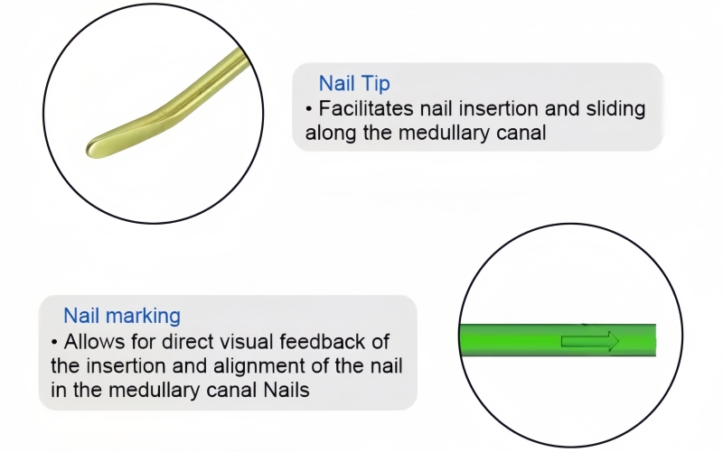 Titanium Elastic Nail