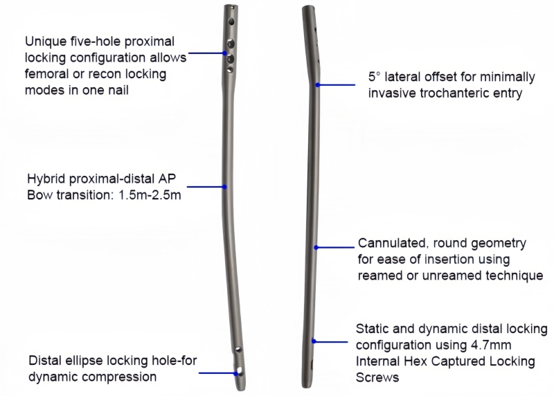 Expert Femoral Nail