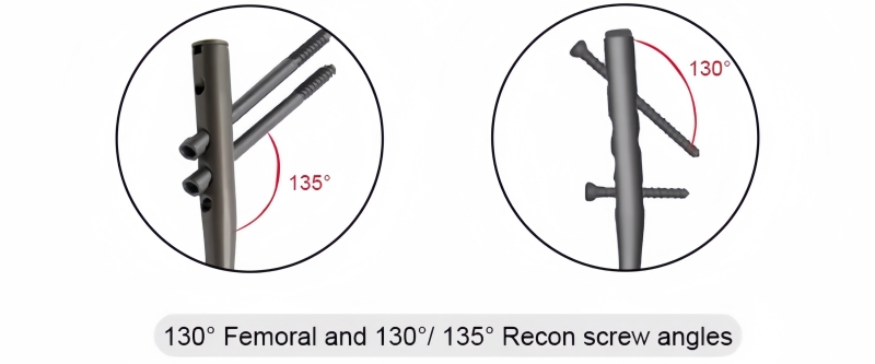 Expert Femoral Nail